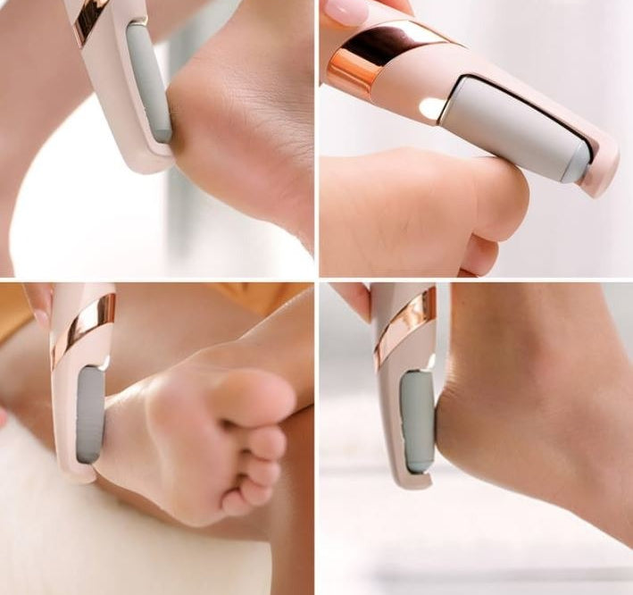 Rechargeable Electric Pedi Foot Filer β Callus Remover for Smooth & Soft Feet